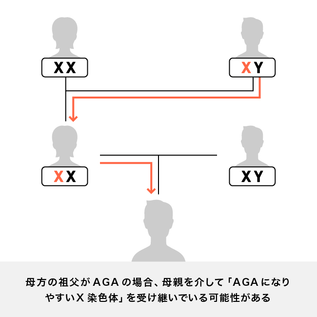 AGAと遺伝の関係