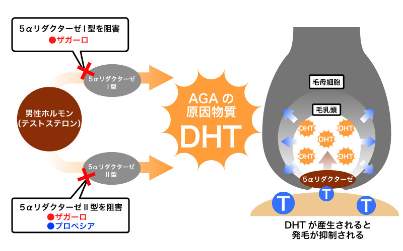DHT（ジヒドロテストステロン）の仕組み