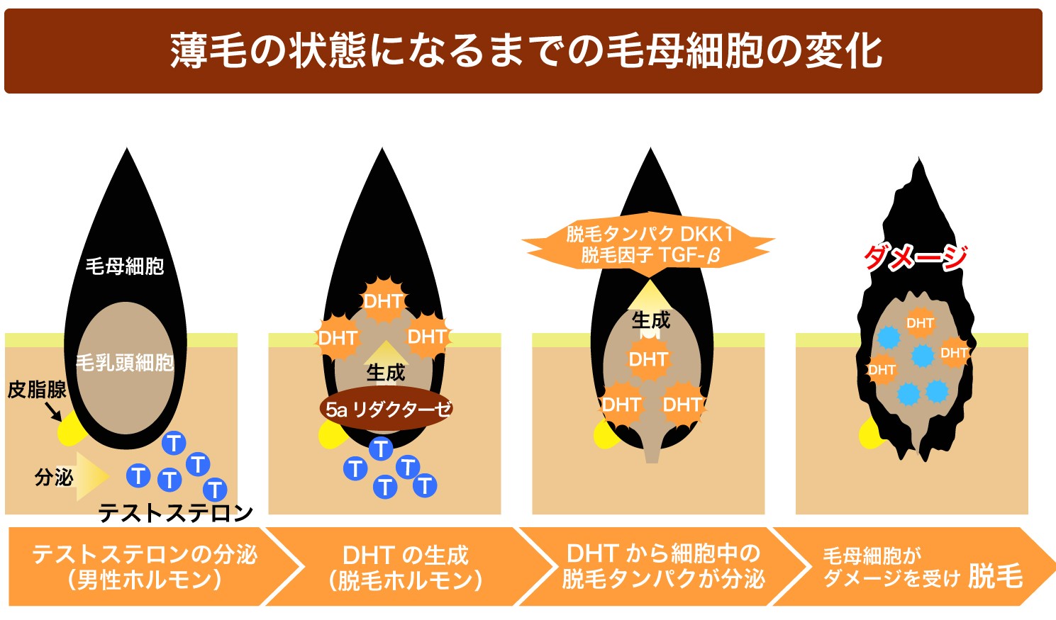 DHT　ジヒドロテストステロン