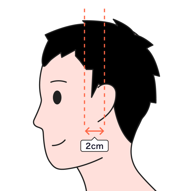 AGAかどうかをセルフチェック