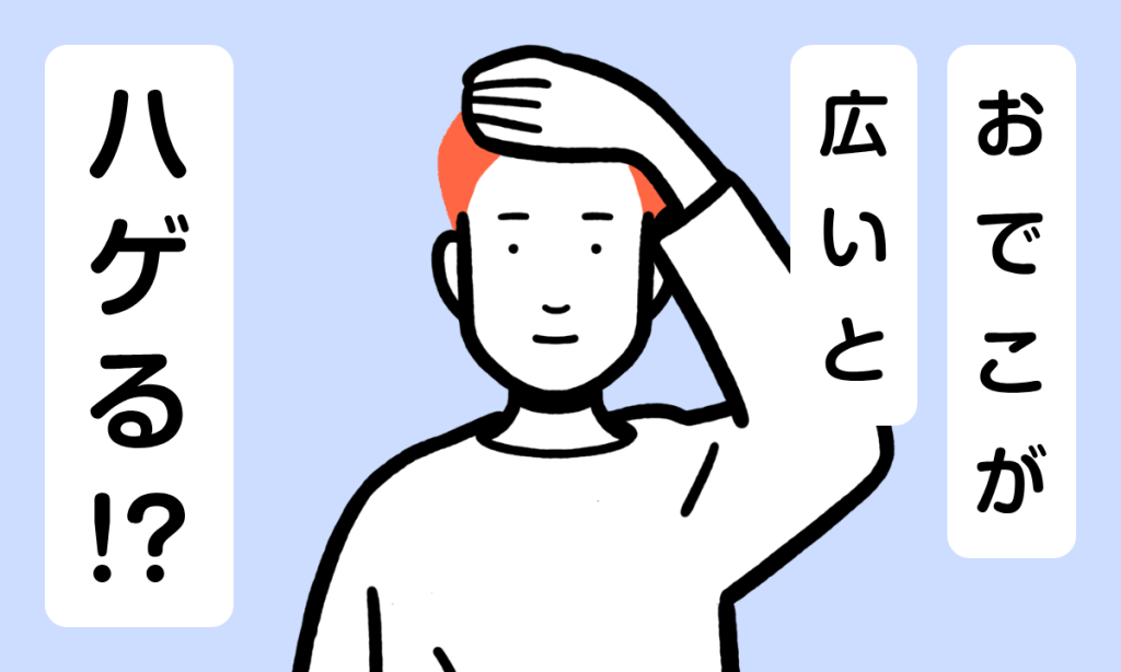 【薬剤師監修】おでこが広い男性におすすめの髪型5選！将来ハゲるって本当？