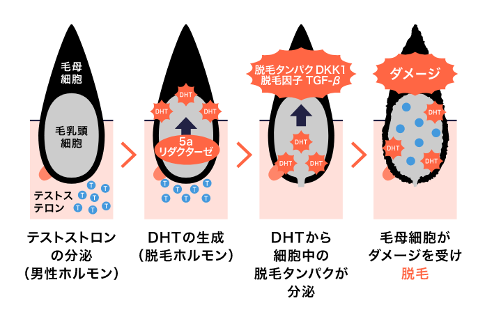 DHT　ジヒドロテストステロン