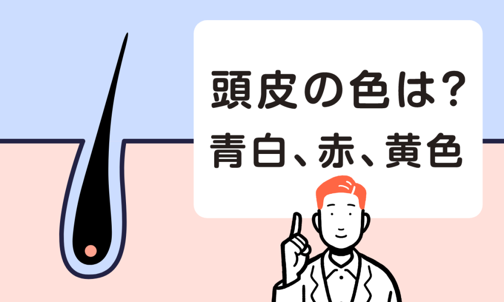 【薬剤師監修】頭皮の色とはげの関係は？青白、赤、黄色などそれぞれの色で解説