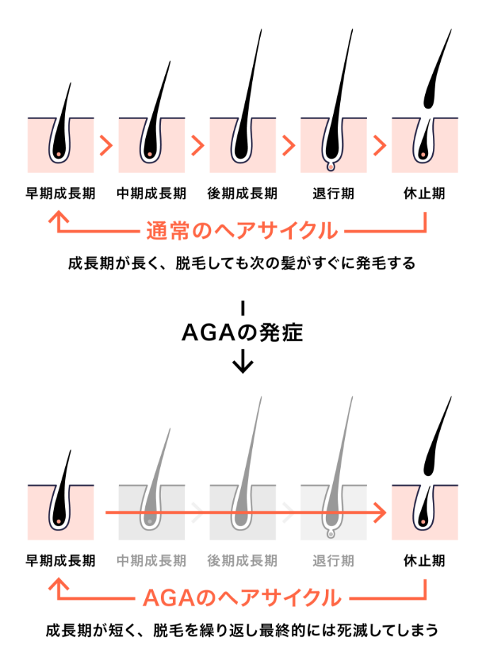 ヘアサイクルの比較