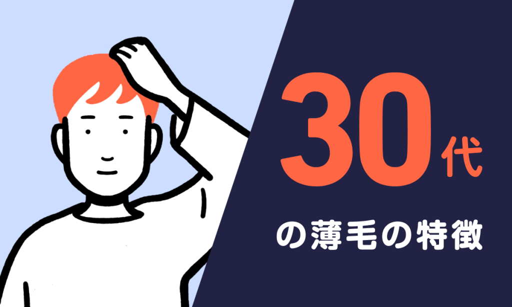 【毛髪診断士監修】30代薄毛の特徴・原因・おすすめ治療法などを徹底解説