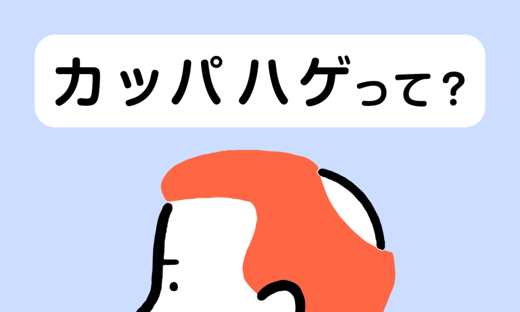 【毛髪診断士監修】カッパハゲは治る？カッパハゲになる原因とチェック方法・おすすめの対処法を解説