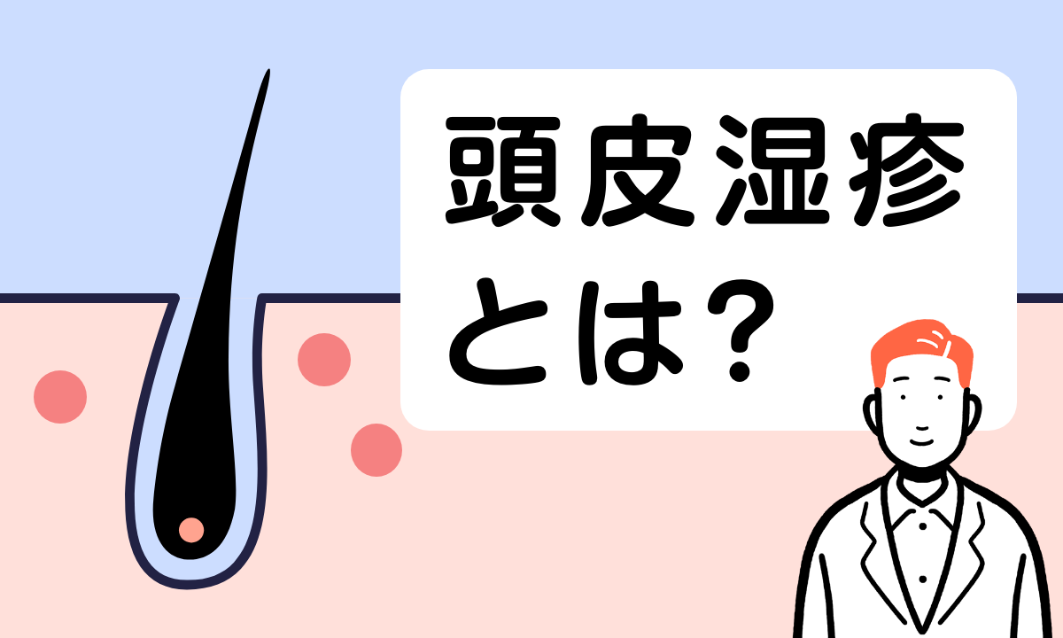 【薬剤師監修】頭皮湿疹の原因は何？どうしたら解決できるの？