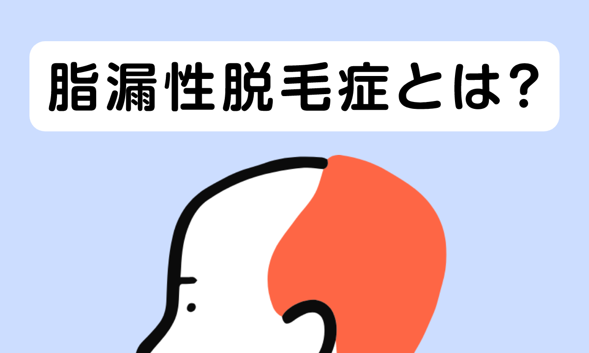 脂漏性脱毛症とは？特徴や原因、AGAとの違いと対処法