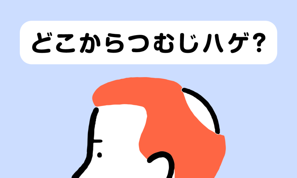 つむじはげの基準ってどこから？頭頂部が薄毛になる原因・対策を紹介！