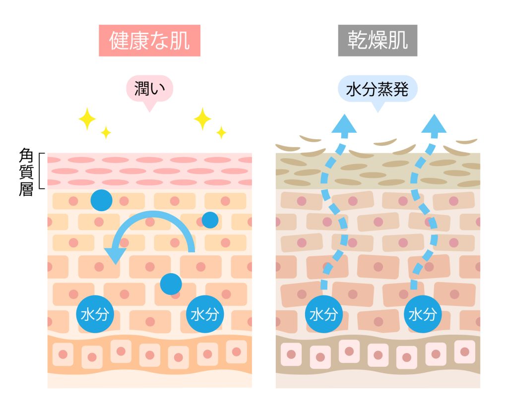 健康な肌と乾燥肌の比較