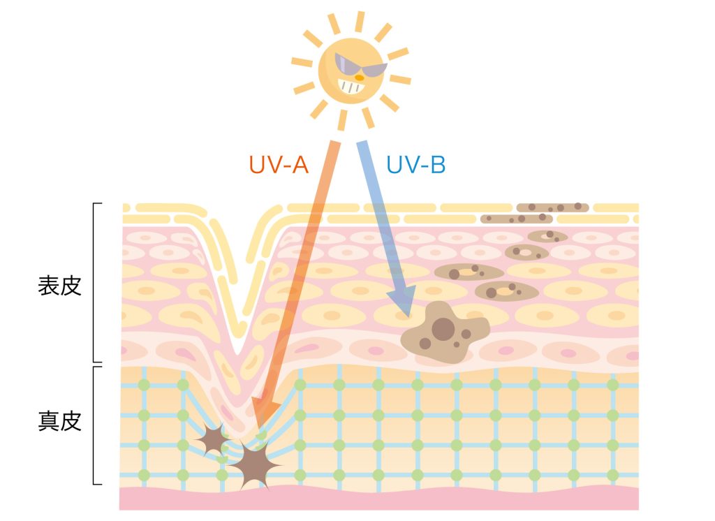 紫外線の肌への影響