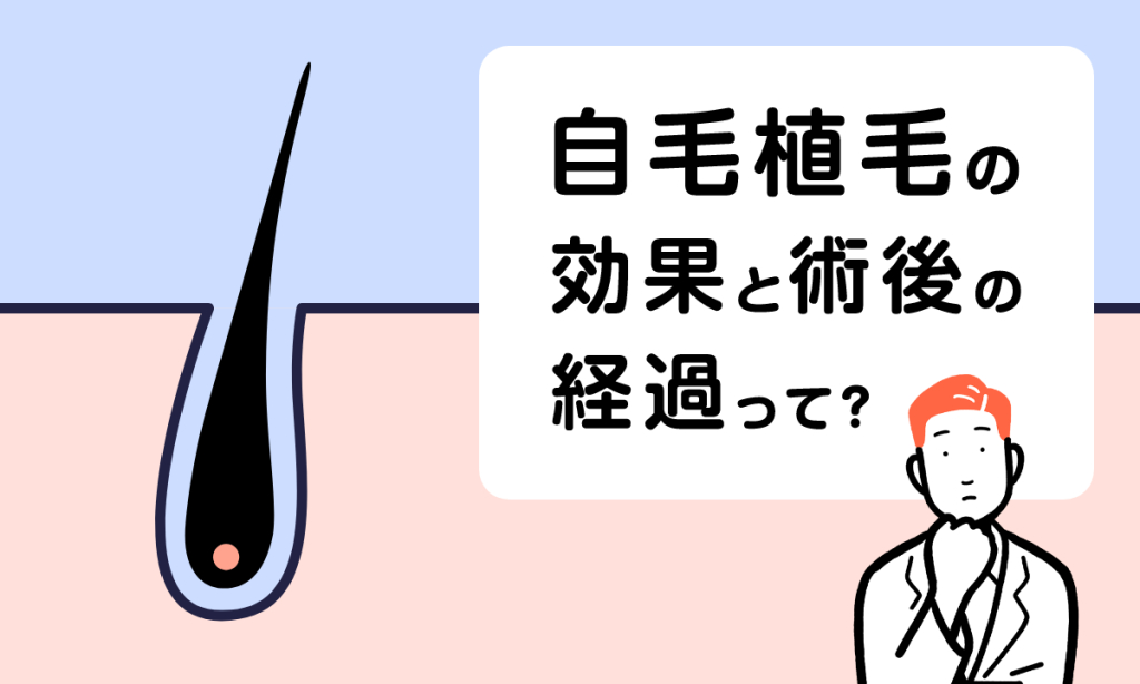 自毛植毛のメリット・デメリット｜効果や費用、術後の経過を分かりやすく解説