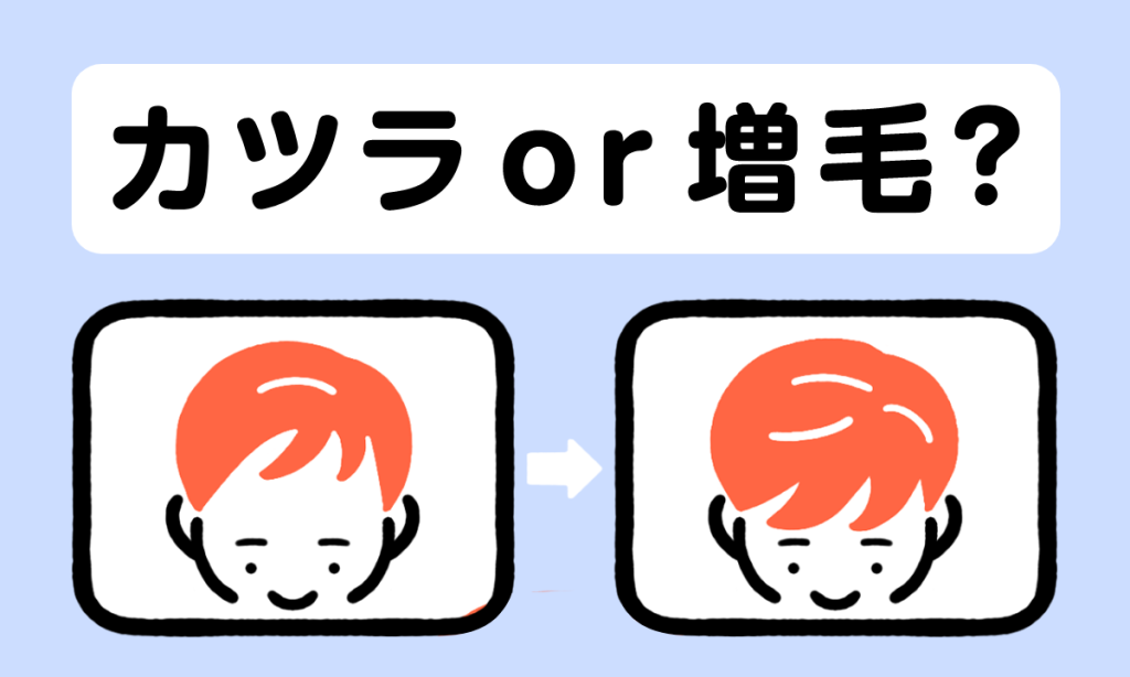 【薬剤師監修】薄毛かくしにはかつら？増毛？それぞれのメリット・デメリットをご紹介！