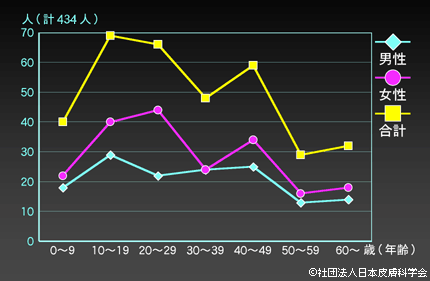 円毛脱毛症とストレスの関係